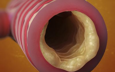 Mucus and Parasites: How to rid our divine bodies of it!